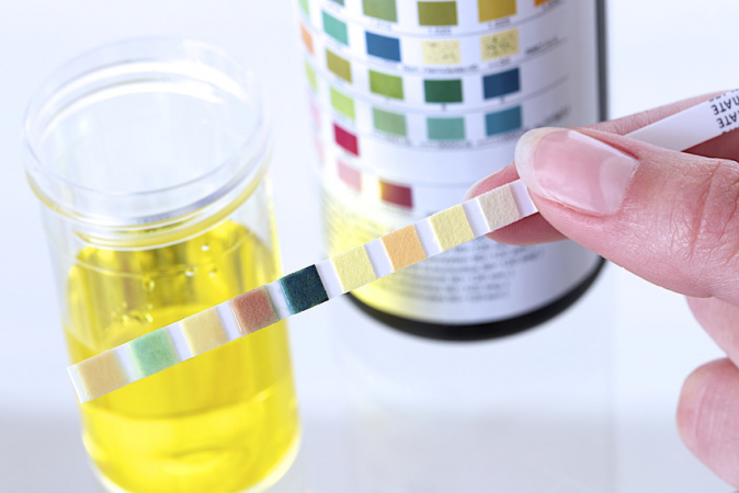 infection urinaire